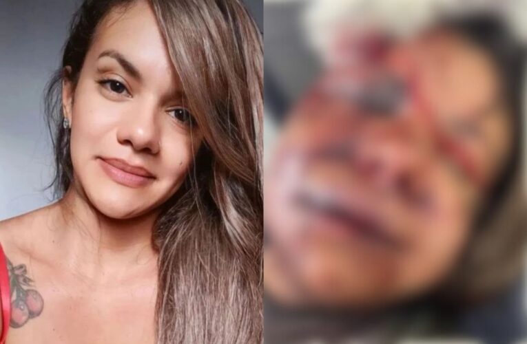 Mulher espancada com mais de 60 socos recebe alta após cirurgia de 7 horas no rosto